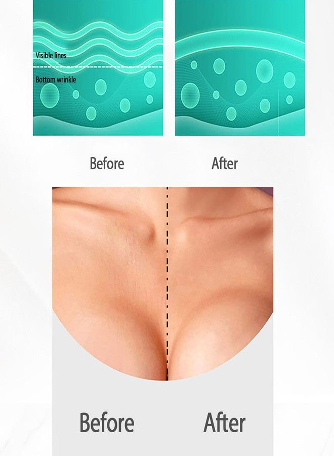 RoseFlower Face Wrinkle Patches Set, 32PCS Facial Patches With Forehead Neck Face Chest Under Eye Patches for Puffy Eyes and Dark Circles, Face Tape Silicone Sleep Patches for Reducing Face Wrinkle - Image 3